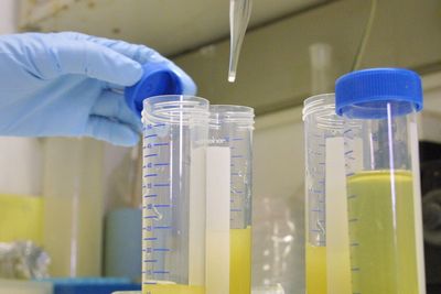 New ‘innovative’ urine test that can detect cancer early could be on NHS within years