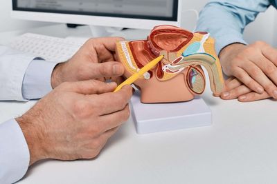 Prostate cancer screening: Final guidance recommends against testing all men