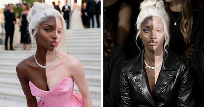 Model Goes Viral For Her Strikingly Unusual Skin Coloration, But There’s A Twist