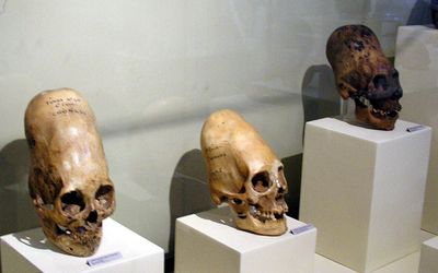 Are the Peru Conehead Mummies Aliens? Paranormal Expert Claims Skulls Are Not Human Beings