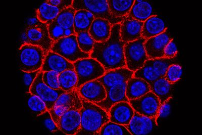 Experimental pill promises new hope for deadly pancreatic cancer