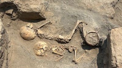 Bronze Age 5-year-old's skull found in Uzbekistan is the oldest known evidence of surgery in Central Asia