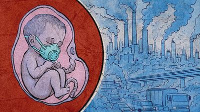 5 years, over 21% rise in preterm birth rate: Delhi’s air is cutting pregnancies short