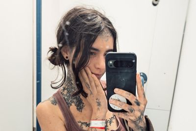 Student’s ‘party trick’ of dislocating joints and stretching skin turns out to be rare condition