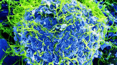 How Far Has Ebola Spread? Italy And Brazil Probe Suspected Cases