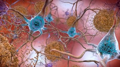 A blood test could flag Alzheimer’s risk early. But how reliable is it?