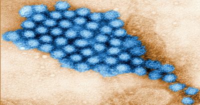 Is a 'Vomiting Virus' Sweeping the US? New Data Reveals Sharp Rise in Norovirus Cases Nationwide