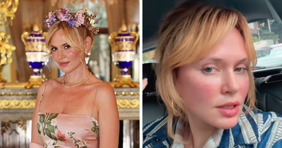 US Influencer Found Under Disturbing Circumstances At 5-Star Hotel After Flying To Brazil For Plastic Surgery