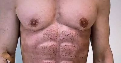 “Time For The Apocalypse”: Man Shows Off His Ab Implants And The Internet Is Collectively Shaking Its Head