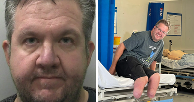 Professional Surgeon Thrown In Prison After Getting His Legs Amputated To Fulfill Intimate Desire And Lying
