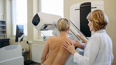 Weight-loss drugs may cut breast cancer risk by up to 30%, study finds