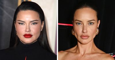 “Lost Another Baddie To Buccal Fat Removal”: 28 Celebrity Collages That Put Rumored Plastic Surgery On Display