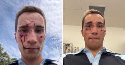 Man accused of assaulting police officer during roadside test to face hearing