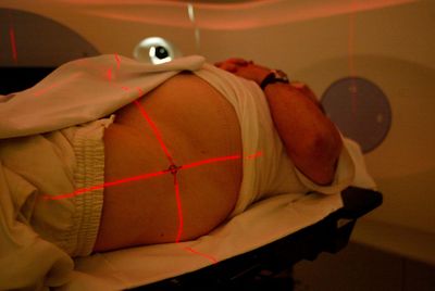 Where American Men Live May Shape Their Odds of Surviving Prostate Cancer, New Study Reveals