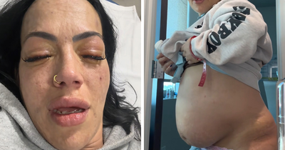 “Your Sign To Stop Now”: Woman’s Story Stuns As She Shares Experience With Liver Failure Due To Drinking