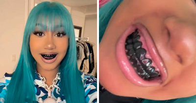 After North West Debuts ‘Blackened Teeth,’ Experts Reveal What Many People Don’t Know About Black Grills
