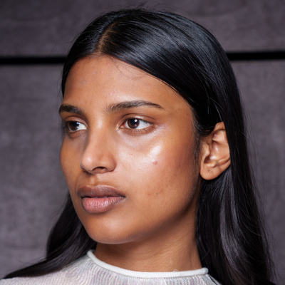 I Started Using a Hypochlorous Acid Spray Daily—and Haven’t Had a Breakout Since