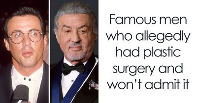 9 Famous Men Whose Faces Changed So Much That Plastic Surgery Rumors Followed