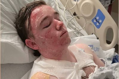 20-Year-Old Jacob Smith Admitted to ICU After Jalani Bluett Throws Hot Oil at a McDonald's; Fundraiser Reaches $96K