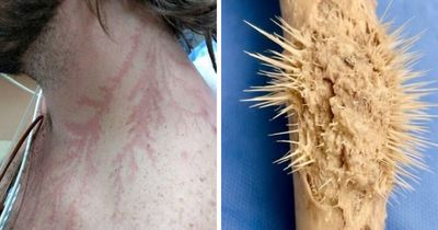 61 Interesting Photos Of Human Body Quirks That Are Both Fascinating And Shocking (New Pics)