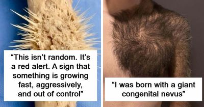 People Are Sharing How Weird Their Bodies Look Or Behave And These 61 Photos Are Fascinating (New Pics)