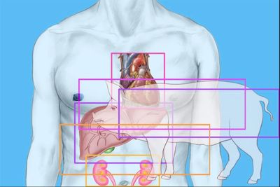 China performs first ever combined transplant of pig liver and kidney to human