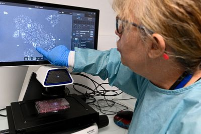 A New Drug Just Nearly Doubled Survival for Pancreatic Cancer Patients — Dallas's UT Southwestern Is at the Forefront of What Researchers Are Calling a Historic Breakthrough