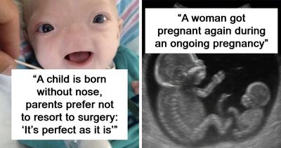 “The Patient Has 81 Teeth”: 61 Facts About Health And The Human Body That Show Just How Strange We Really Are