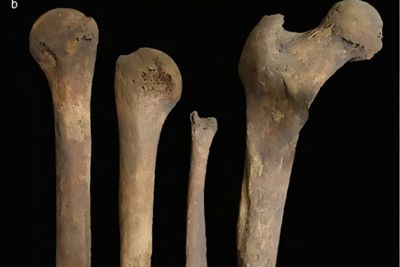 Iron Age Britons likely removed corpse brains in strange funeral ritual