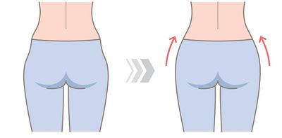 Hip dips: what are they and can you really get rid of them?