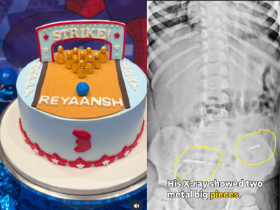 Birthday horror! 3-year-old swallows metal wires hidden in cake decorations in Mumbai
