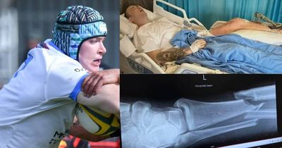 Family, club make desperate plea after tackle causes horrific injuries
