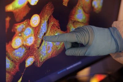 SLAMF6 Cancer Discovery 2026: Scientists Identify Hidden T Cell Brake That Explains Why Immunotherapy Fails