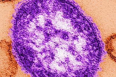 Two children die from measles as more cases confirmed in London this month