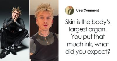 Machine Gun Kelly Reveals Frightening Side Effects Of Covering Body In Tattoo Ink, Doctors Unveil The Dangers