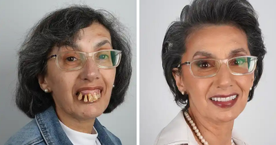 10 Jaw-Dropping Before-And-After Collages Of Women Who Underwent Extensive Smile Makeovers
