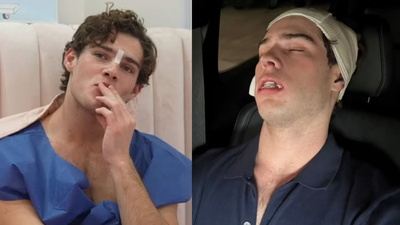 How many surgeries has streamer Clavicular completed ahead of Paris Fashion Week? His Ascension Week shocks fans
