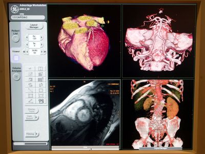 Perimenopause Doubles Cardiovascular Risk and Women Are Still Not Being Referred for Advanced Heart Care — Two New Studies Expose a Critical Gap in Women's Heart Health
