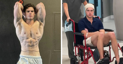 Looksmaxxer Clavicular Just Had His 3rd Surgery, And People Are Getting Concerned About His Transformation