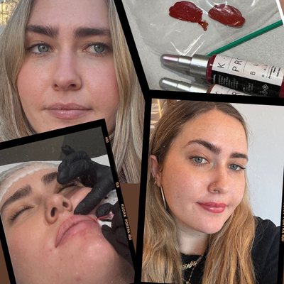 My Lips Were Pale, Dry, and High-Maintenance—Then I Got Lip Blush.