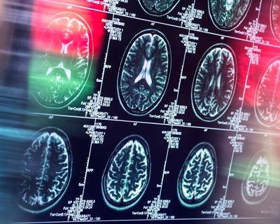 Antidepressants and antipsychotics could serve as alternatives to opioids, study finds