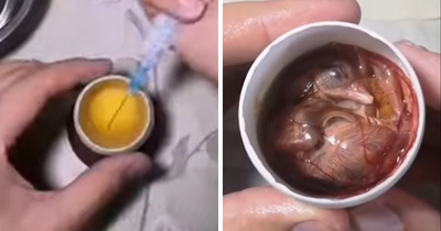 “Quite Horrifying”: Man Successfully Grows A Chicken In An Open Egg And Gets It On Video