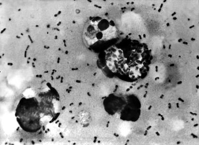 A Woman Dies of Plague in New Mexico as Summer Brings Higher Risk of the Ancient Disease Across the American Southwest