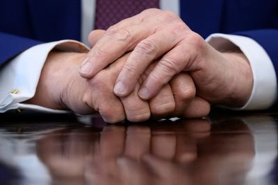 Trump shows up to UFC bash with a hand everyone noticed