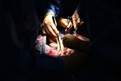 Dangerous Herpesvirus Infections in Organ Transplant Recipients Rise Fivefold Amid Lack of Routine Donor Screening