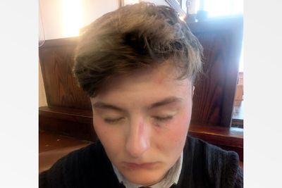 Teen Activist Says He Was Knocked Unconscious After Violent Attack During Manchester Event