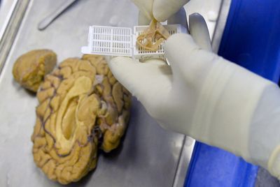Copper Compound Cu(ATSM) Cleared 42% of Alzheimer's Toxic Proteins and Restored Memory in Lab — ACS Chemical Neuroscience June 2026