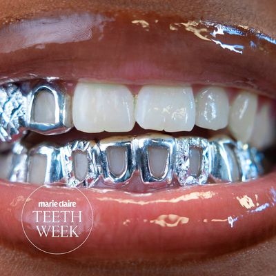 My Grillz Helped Me Finally Understand a Part of My Diasporic Heritage
