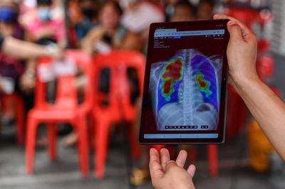 Singapore TB Cluster at Bedok Food Centre: 473 People Need Follow-Up Testing After CDA Screening