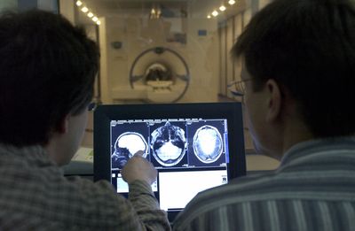 University of Florida Study Warns Glucosamine Users After Finding Link to 25% Faster Alzheimer's Disease Progression